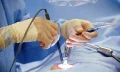 Endoscopic Spine Surgeries