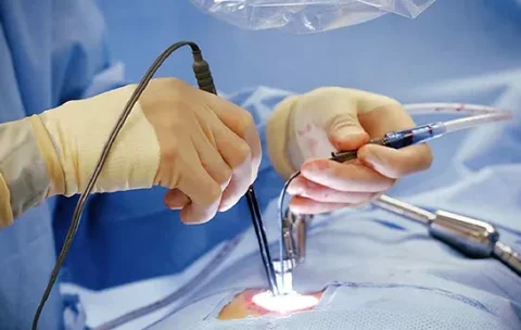 Endoscopic Spine Surgeries