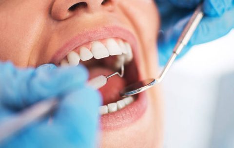 Open female mouth during oral checkup at the dentist. Selective focus.