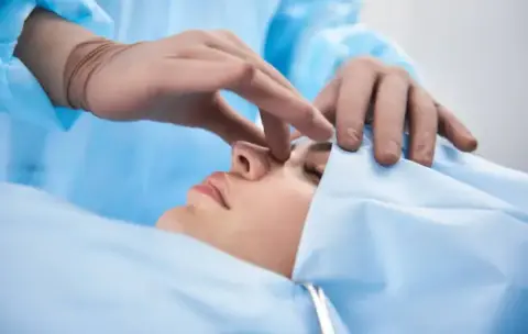 rhinoplasty